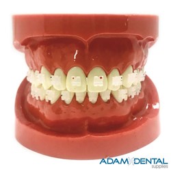 Upper And Lower Arch with Ceramic Brackets Dental Education Demonstration Models