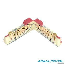 Cross Section of Quadrant Dental Demonstration Model