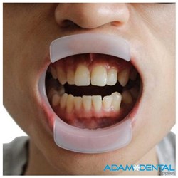 O Shaped Mouth Opener Retractor 10/pack