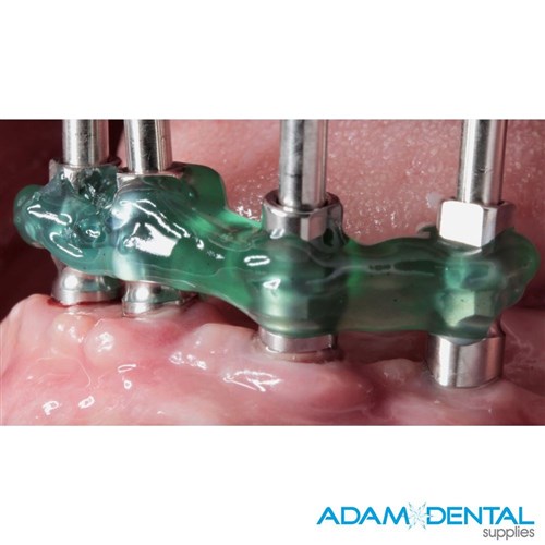 TDV Resinlay Pattern Gel 3g Light Cure