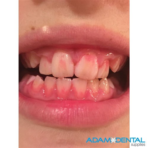 PDS Plaque Disclosure Gel 30ml