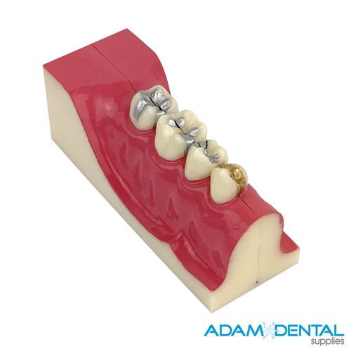 Cross Section of Quadrant Dental Demonstration Model