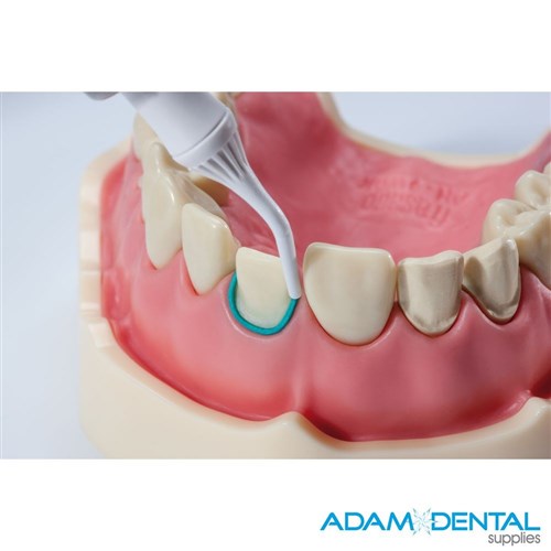 Retraction Paste Flexible Cannula Pk 25x 0.37g Compules