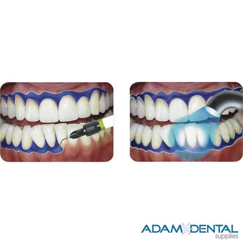 Rubber Dam Gingival Liquid